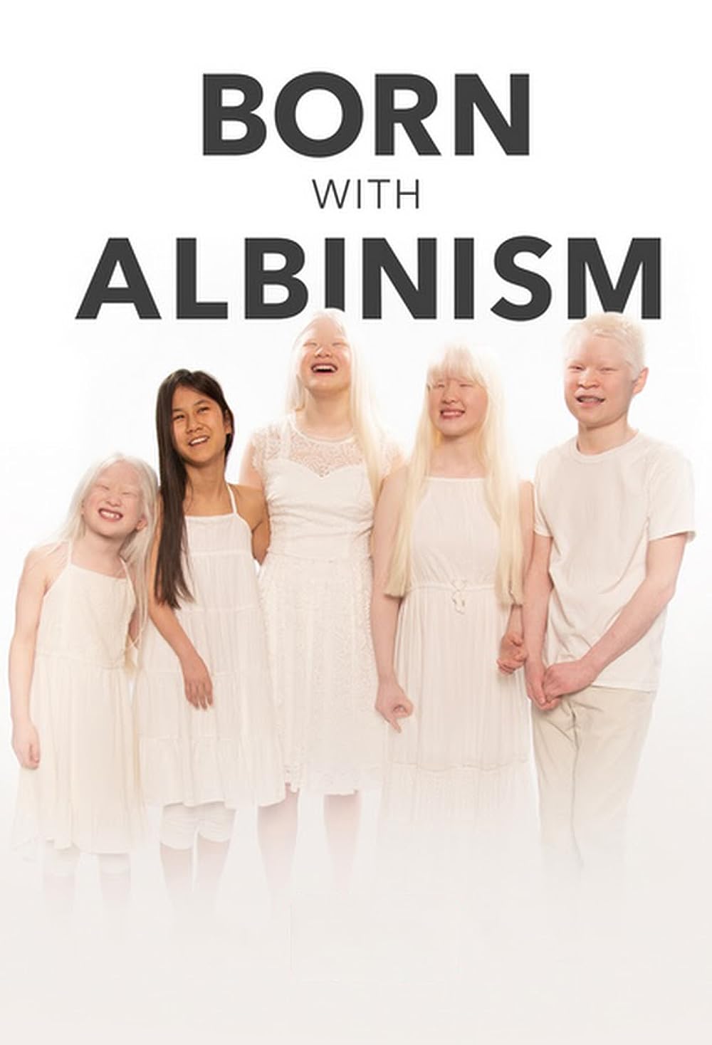     Urodzeni z albinizmem